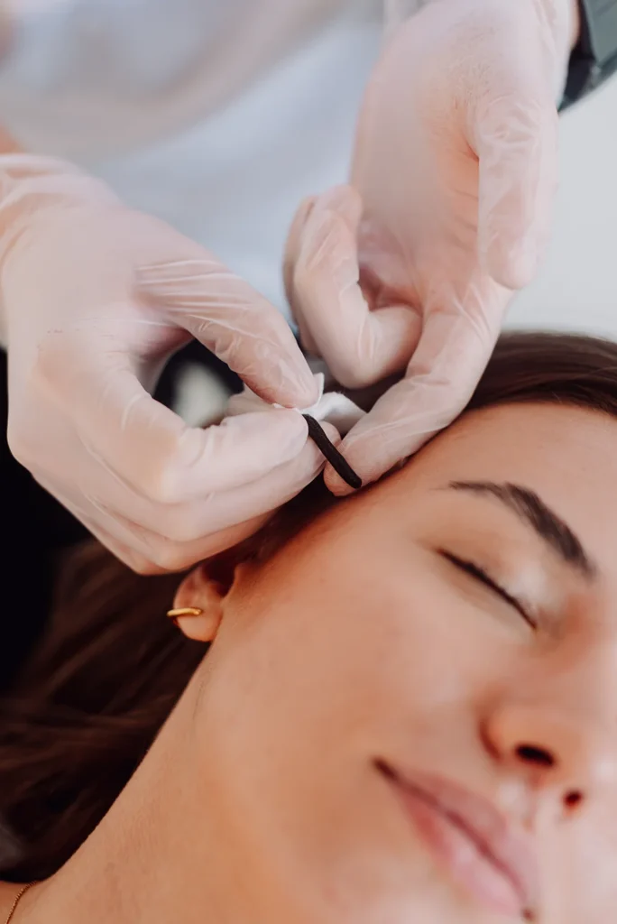 Hirudoterapia w Uzdrovisko – terapeuta w rękawiczkach aplikuje leczniczą pijawkę na skórę pacjentki w okolicy ucha.